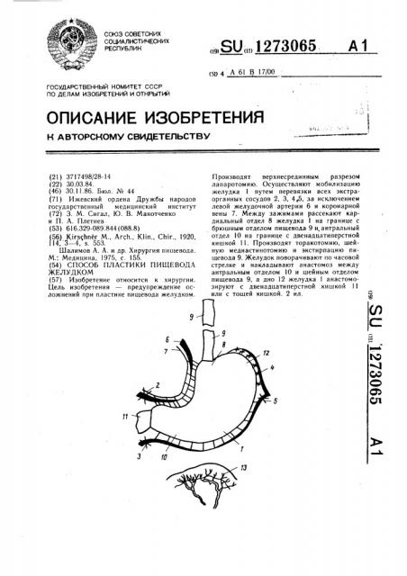 Способ пластики пищевода желудком (патент 1273065)