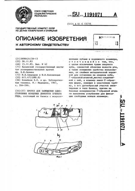 Протез для замещения односторонних концевых дефектов зубного ряда (патент 1191071)