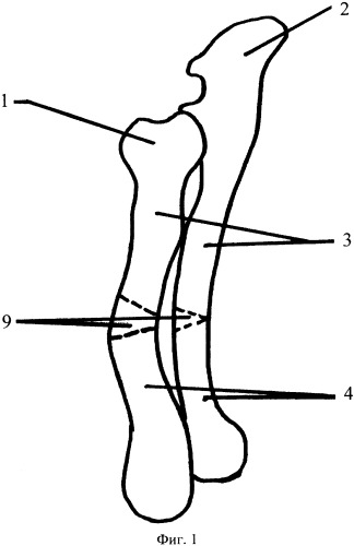 Способ коррекции деформаций костей предплечья у животных (патент 2350281)