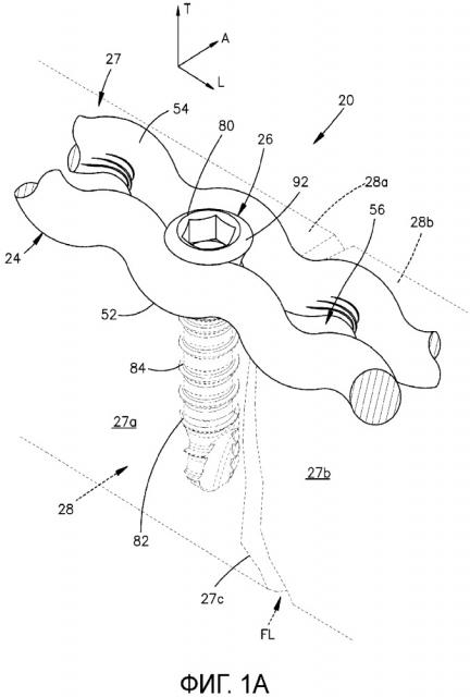 Система фиксации кости (патент 2648850)