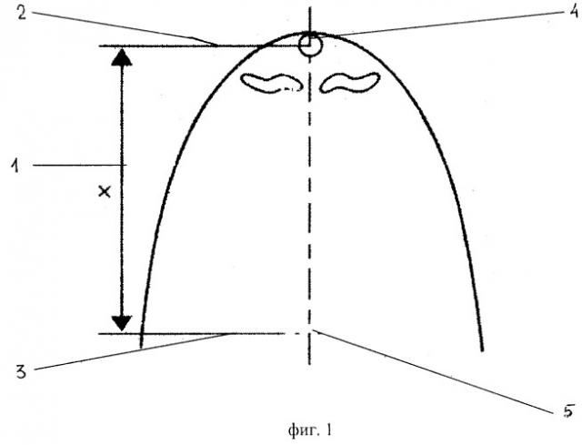 Устройство для определения длины центральных резцов верхней челюсти (патент 2262327)