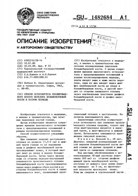 Способ остеосинтеза изолированного косого перелома большеберцовой кости в остром периоде (патент 1482684)