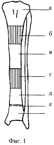Способ количественной оценки сосудистого русла кости (патент 2270600)