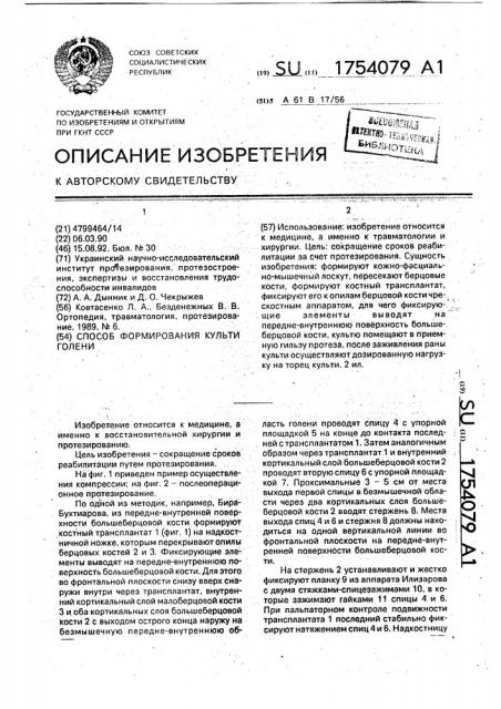 Способ формирования культи голени (патент 1754079)