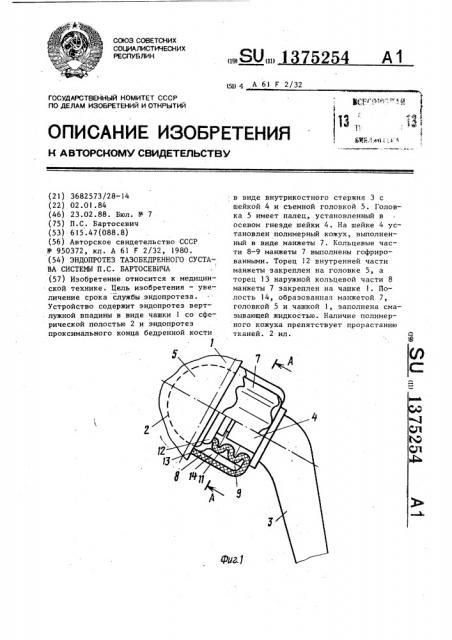 Эндопротез тазобедренного сустава системы п.с.бартосевича (патент 1375254)