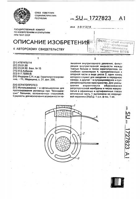 Кератопротез (патент 1727823)