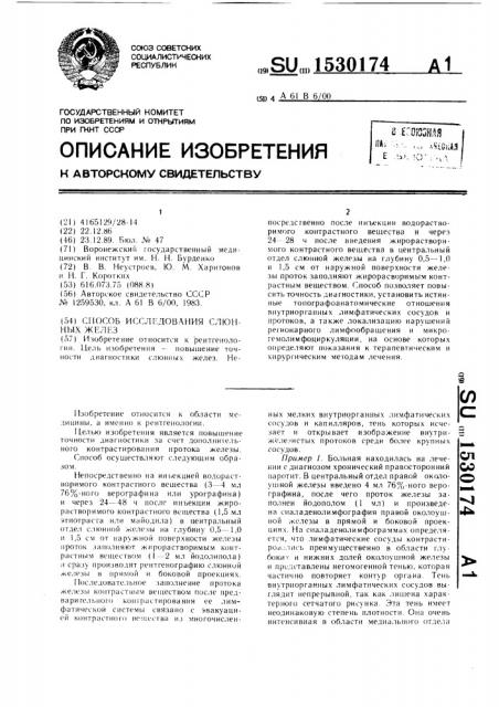 Способ исследования слюнных желез (патент 1530174)