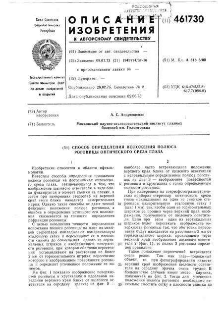 Способ определения положения полюса роговицы оптического среза глаза (патент 461730)