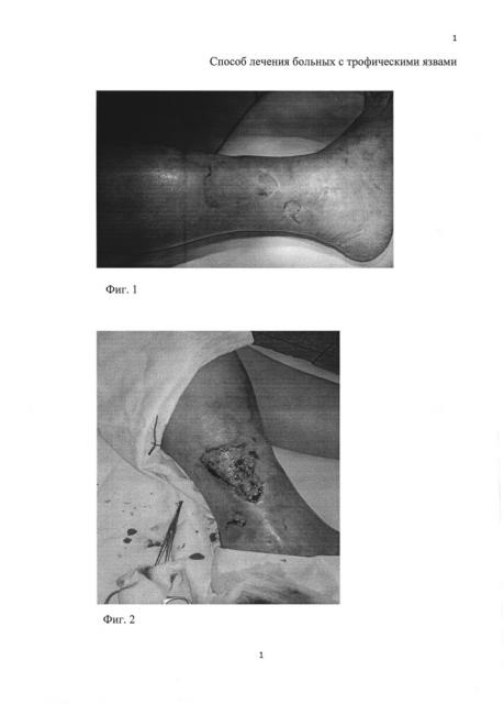 Способ лечения больных с трофическими язвами (патент 2620498)