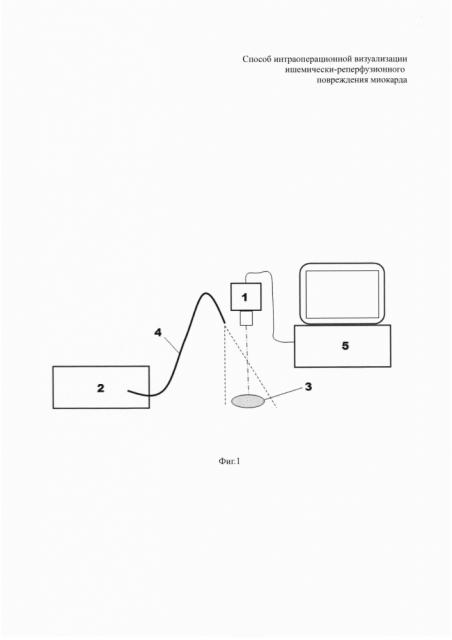 Способ интраоперационной визуализации ишемически-реперфузионного повреждения миокарда (патент 2622983)