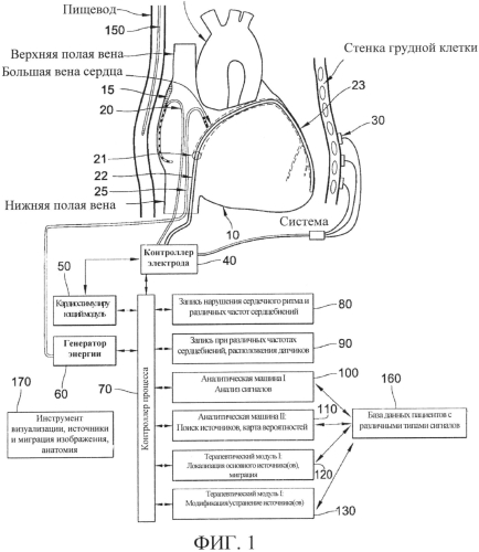 Способы, система и устройство для обнаружения, диагностики и лечения нарушений биологического ритма (патент 2556974)