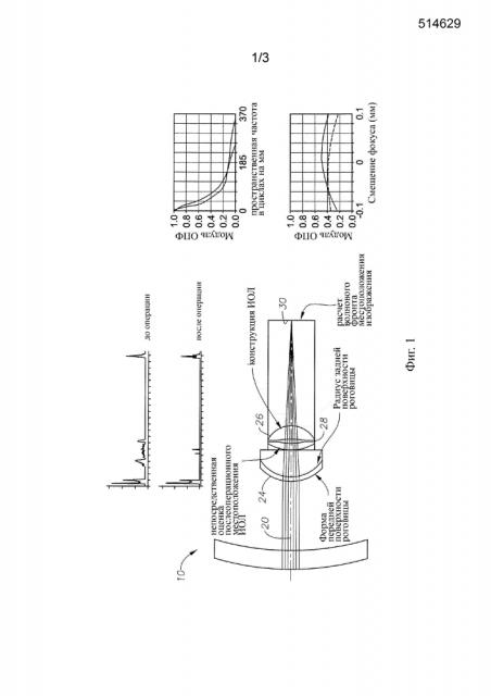 Расчет оптической силы интраокулярной линзы (иол) в соответствии с непосредственно определенным положением иол (патент 2633317)