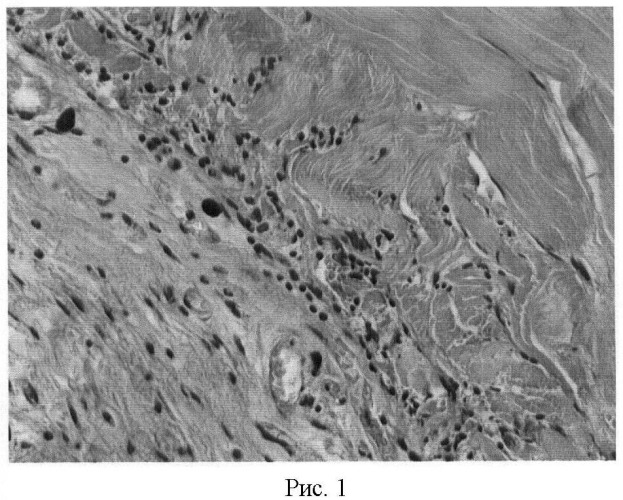 Биологический материал подложки тканевых эквивалентов слизистых оболочек (патент 2445124)