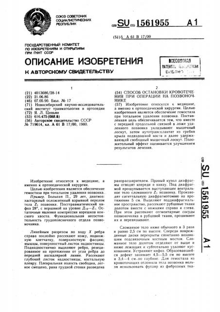 Способ остановки кровотечения при операции на позвоночнике (патент 1561955)