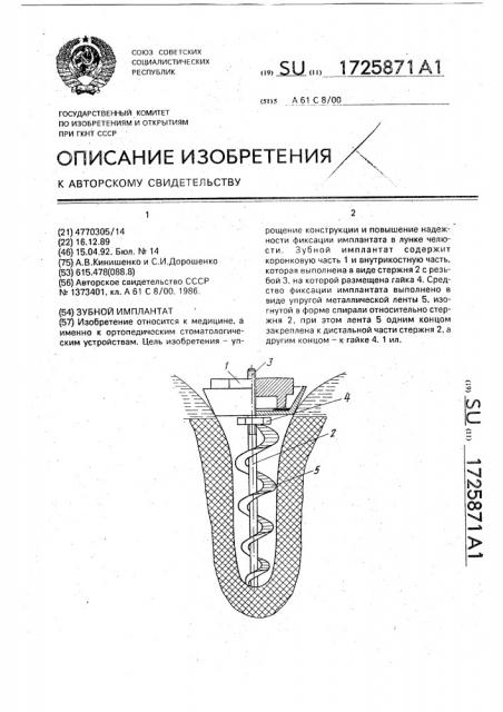 Зубной имплантат (патент 1725871)