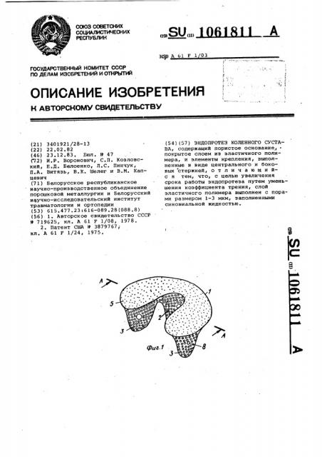Эндопротез коленного сустава (патент 1061811)