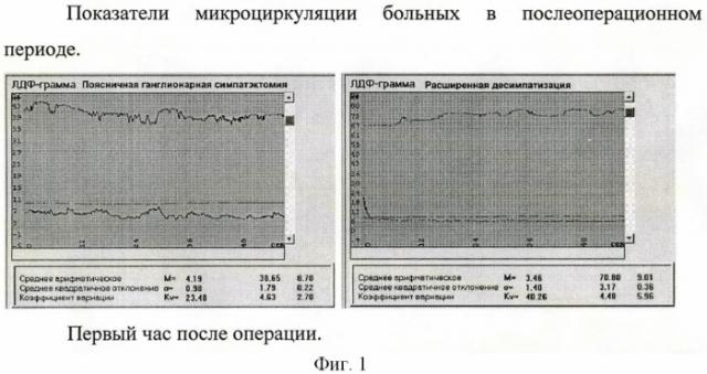 Способ комбинированной десимпатизации у больных с хронической ишемией нижних конечностей (патент 2441603)