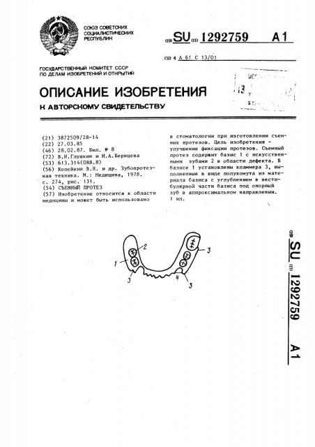 Съемный протез (патент 1292759)