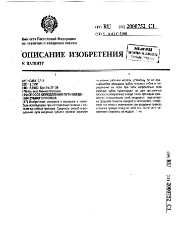 Способ определения пути введения зубного протеза (патент 2000752)