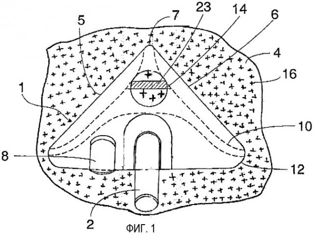 Всасывающее устройство пылесоса (патент 2331352)
