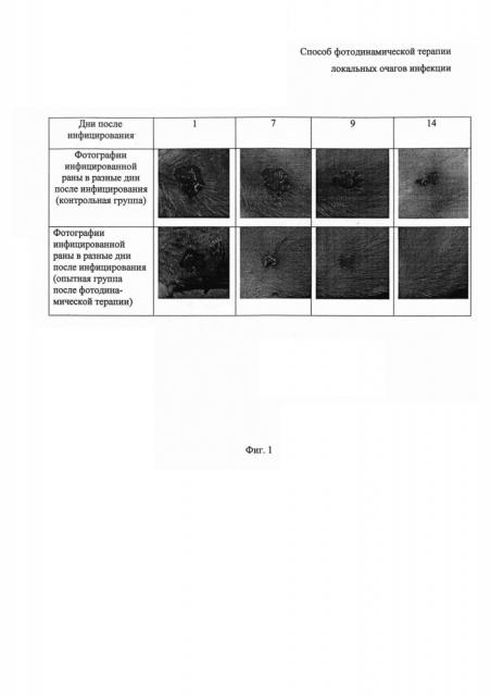 Способ фотодинамической терапии локальных очагов инфекции (патент 2610566)