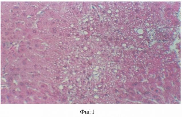 Гепатопротектор (патент 2325158)