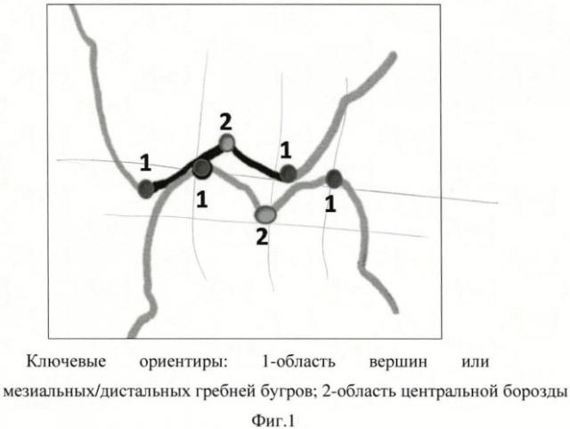 Способ измерения размеров зубов, зубных бугров и их внутренних и наружных скатов (патент 2438617)