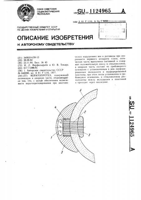 Кератопротез (патент 1124965)