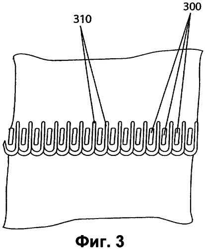 Способ и устройство для стабилизации петель несшитых швов (патент 2344216)