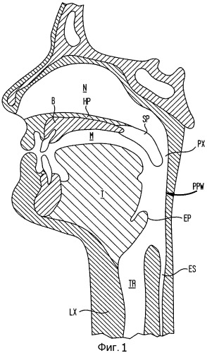 Системы имплантатов и способы лечения обструктивного апноэ во сне (патент 2515765)