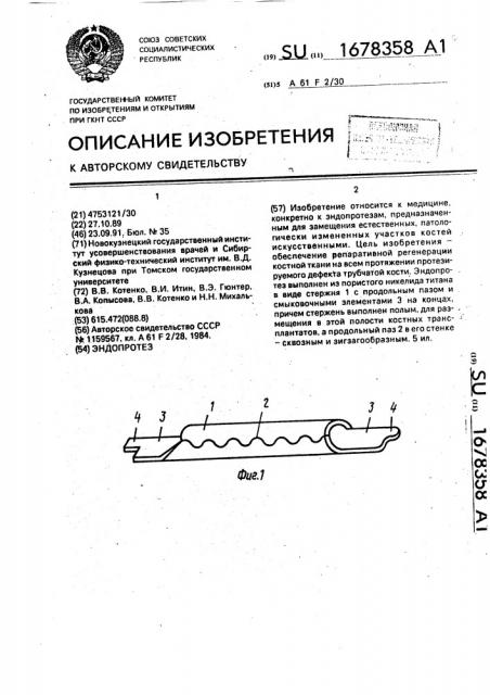 Эндопротез (патент 1678358)