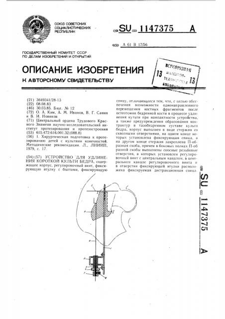 Устройство для удлинения короткой культи бедра (патент 1147375)