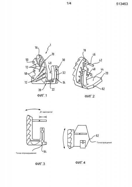 Направляющая резания для создания наружного контура для эндопротеза сустава (патент 2599680)