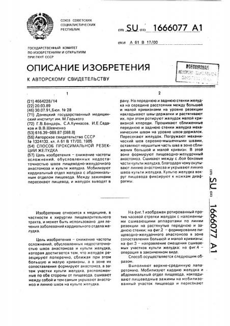 Способ проксимальной резекции желудка (патент 1666077)