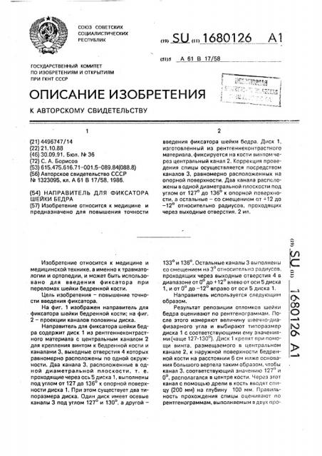 Направитель для фиксатора шейки бедра (патент 1680126)