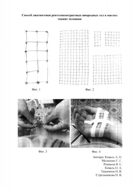 Способ диагностики рентгенконтрастных инородных тел в мягких тканях человека (патент 2605148)