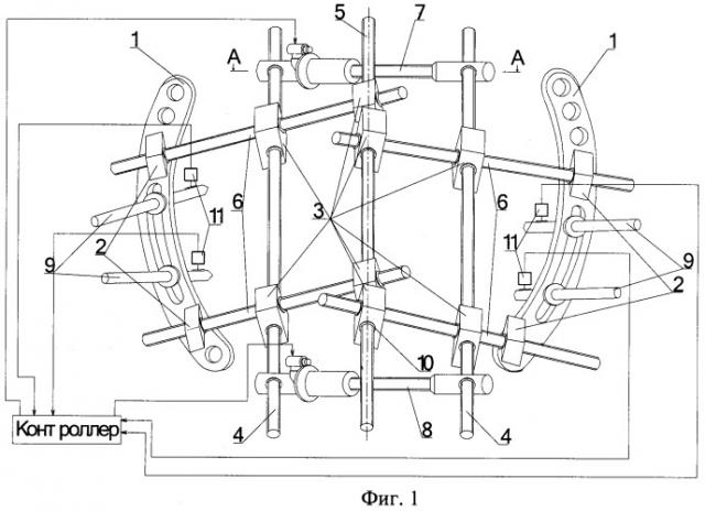 Устройство для репозиции и фиксации переломов костей таза с разрывом переднего и заднего полуколец (патент 2372869)