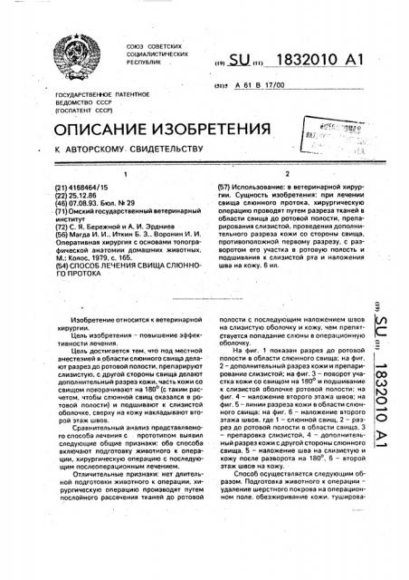 Способ лечения свища слюнного протока (патент 1832010)