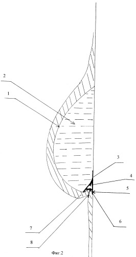 Имплантат молочной железы (патент 2340308)