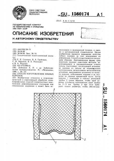 Способ изготовления зубных коронок (патент 1560174)