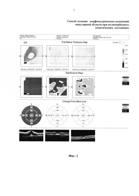Способ лечения морфометрических изменений макулярной области при полиморбидных соматических состояниях (патент 2622759)