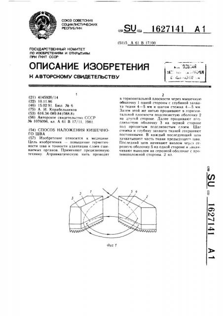 Способ наложения кишечного шва (патент 1627141)