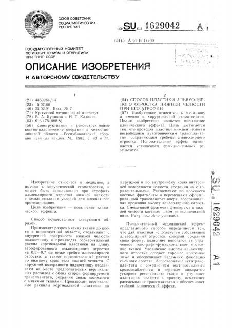 Способ пластики альвеолярного отростка нижней челюсти при его атрофии (патент 1629042)