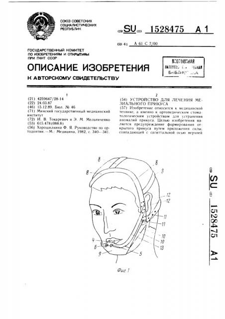 Устройство для лечения мезиального прикуса (патент 1528475)