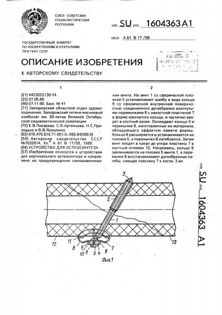 Устройство для остеосинтеза (патент 1604363)