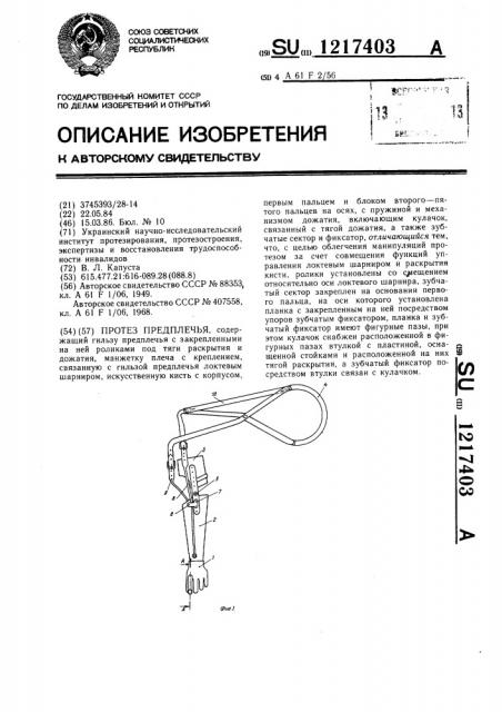 Протез предплечья (патент 1217403)