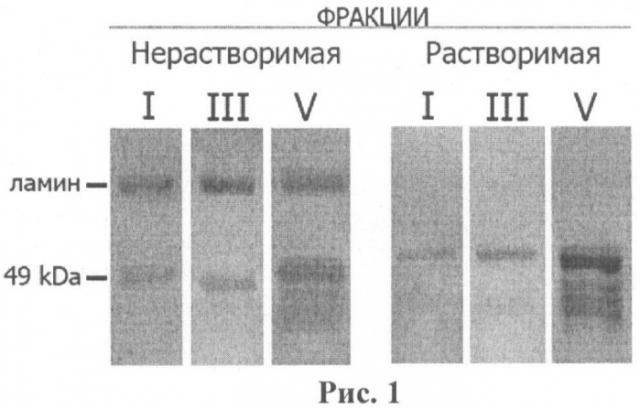 Способ профилактики и лечения осложнений сахарного диабета, связанных с развитием дегенеративных процессов в нервной ткани, фармацевтическая композиция для нейропротективной терапии таких осложнений и способ ее получения (патент 2484844)