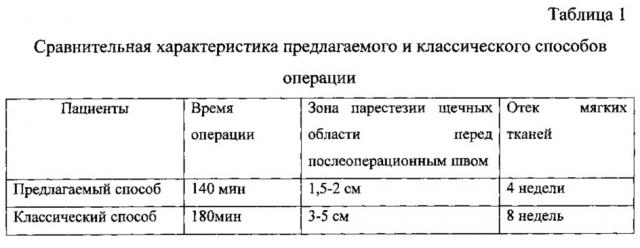 Способ фиксации поверхностной мышечно-апоневротической системы при операции по подтяжке лица (патент 2634642)