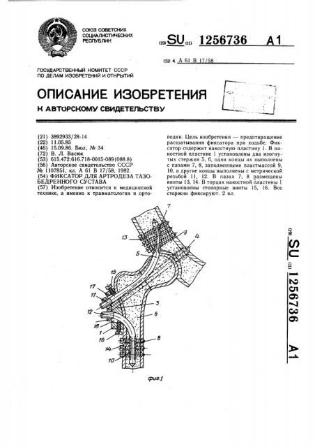 Фиксатор для артродеза тазобедренного сустава (патент 1256736)