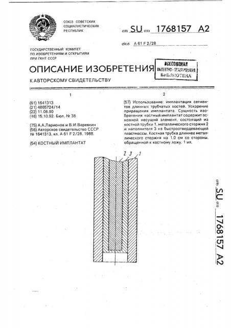 Костный имплантат (патент 1768157)